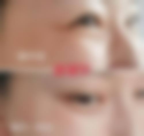 东莞市人民医院烧伤整形美容外科2026年价格收费表: