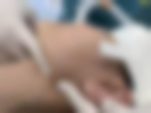 东莞市人民医院烧伤整形美容外科医生团队经验稳定。