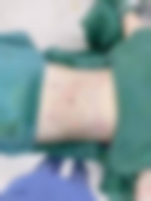 阜新丽森整形医院医生团队经验稳定