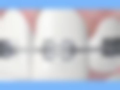 南京博莱美口腔诊所擅长项目。