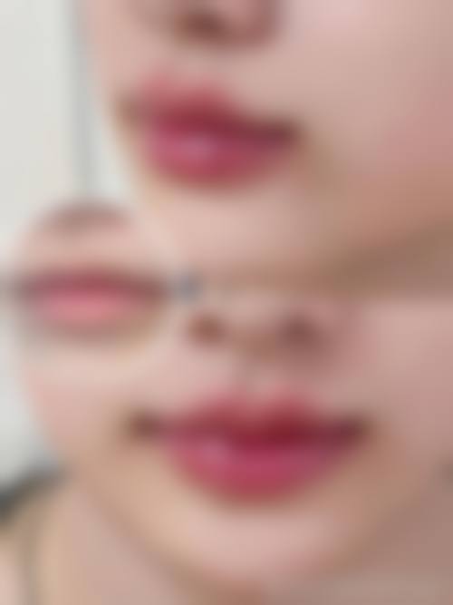 深圳铂诗玥医疗美容诊所擅长项目。