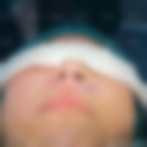 阜新丽森整形医院治疗反馈与口碑评价