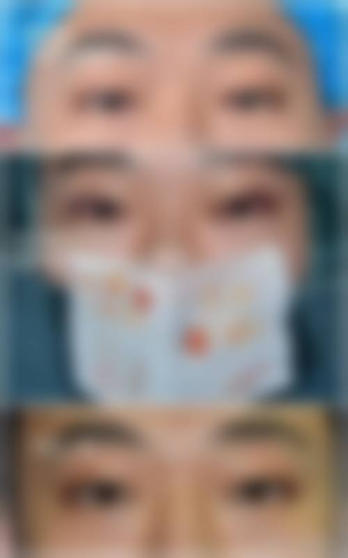 阜新丽森整形医院擅长项目