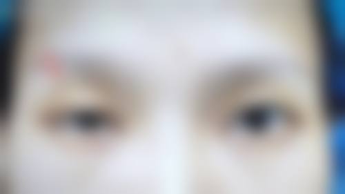 北京平乐园铂林眼科诊所预约挂号方式。