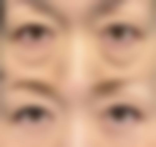 长沙美之峰医疗美容机构治疗反馈与口碑评价。