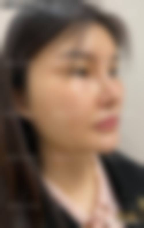 深圳瑞泽瑞尼丝整形口腔医院医生团队经验稳定。