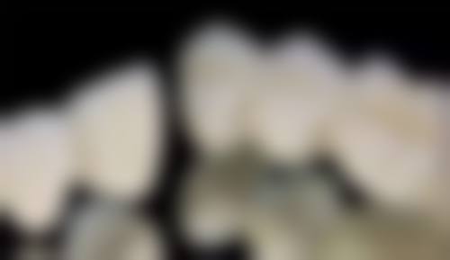 唐山英卓口腔医院预约挂号方式。