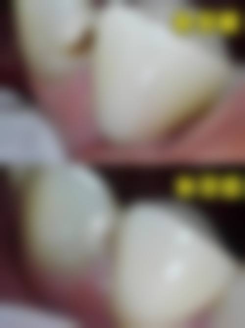 张双越医生擅长项目介绍