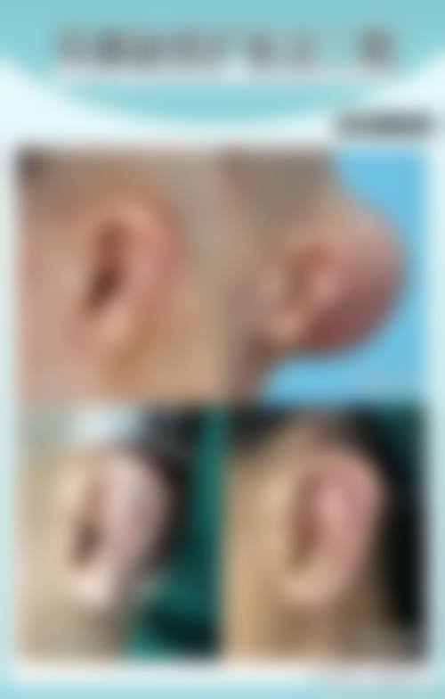日本Noel银座美容整形医院治疗反馈与口碑评价。