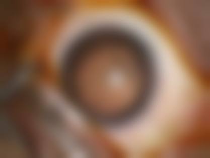 广州佰视佳眼科医院预约挂号方式。