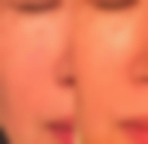长沙美之峰医疗美容机构地理位置便于到院。