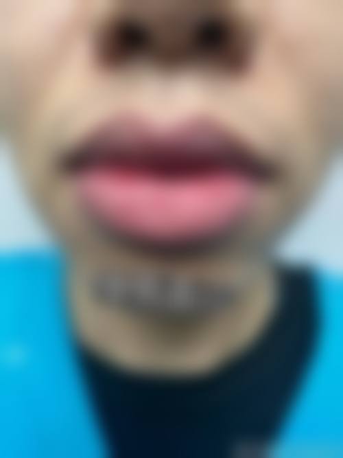 日本Noel银座美容整形医院擅长项目。