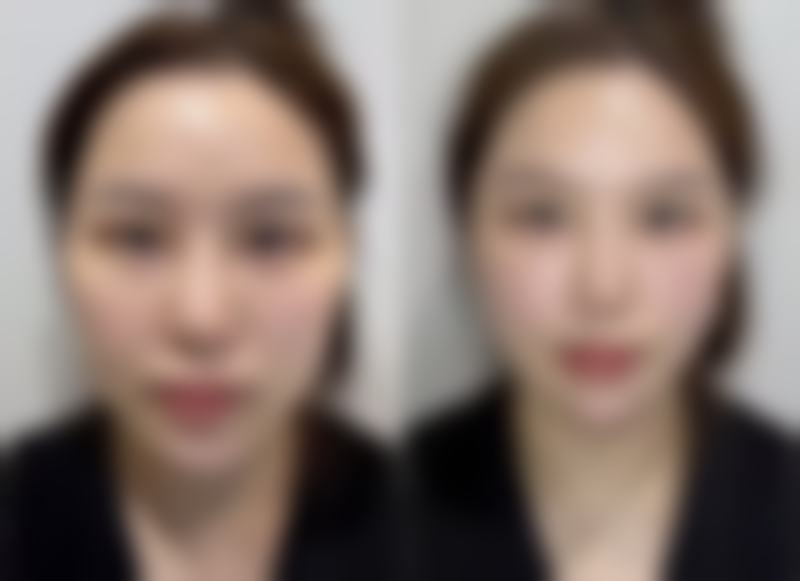 石家庄越然医疗美容医院设备情况