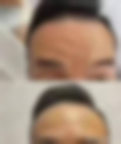 兰州明伦医疗整形美容门诊部治疗反馈与口碑评价。