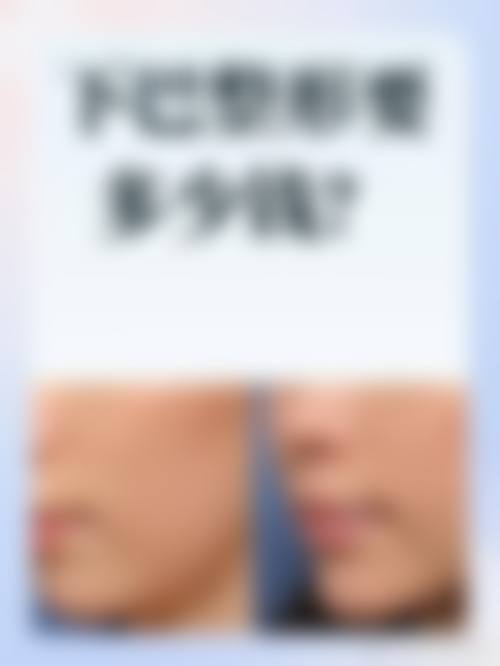 西安瑞丽整形美容医院擅长的项目