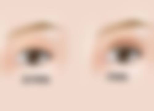 贵阳普瑞眼科医院擅长项目。