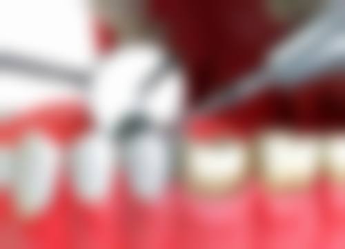 北京美冠塔口腔连锁(酒仙桥分院)口碑评价揭秘