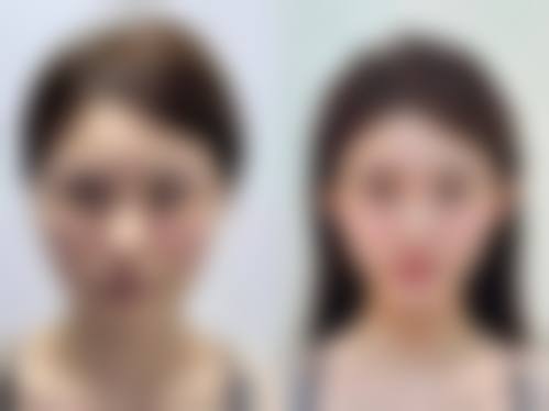 成都格莱丽整形医院口碑评价