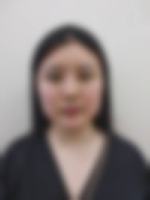 乌鲁木齐晏莎医疗美容诊所预约挂号方式。