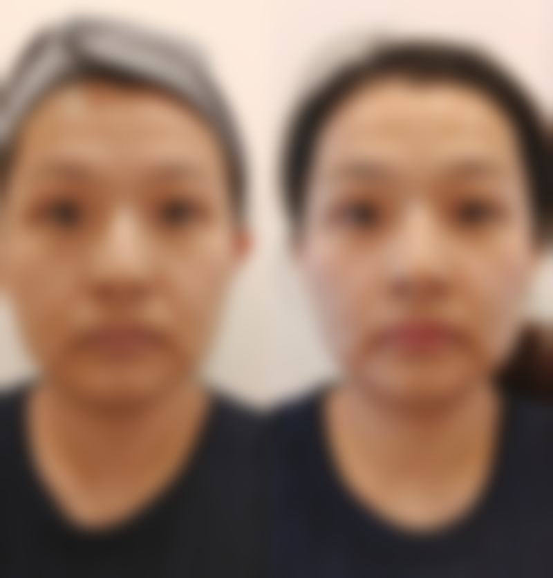 吕光全医生擅长项目