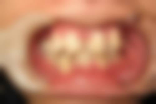 湖州优鑫美口腔门诊部擅长项目。