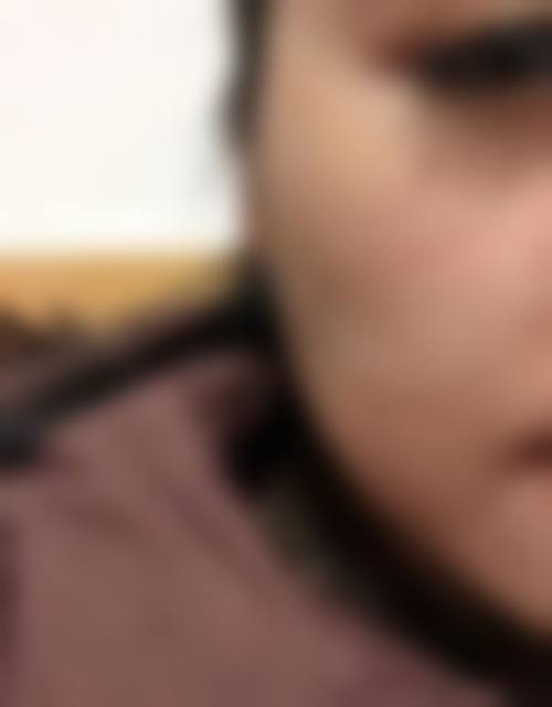 永康芙洛拉医疗美容门诊部治疗反馈与口碑评价。