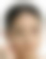 海口百龄整形医院治疗反馈与口碑评价。