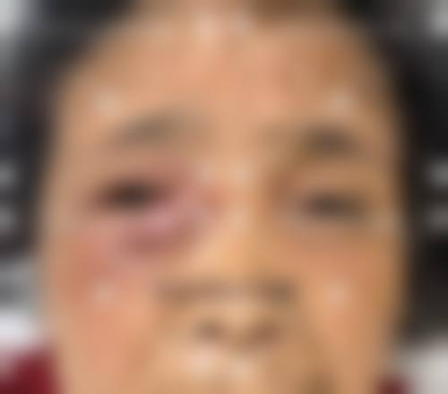 长春市中医院眼科治疗反馈与口碑评价。