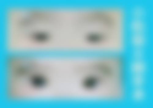 辽宁省精神卫生中 心眼科治疗反馈与口碑评价。