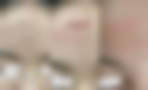 西宁青北皮肤病医院预约挂号方式。