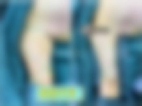 海南煌越医疗美容擅长项目。