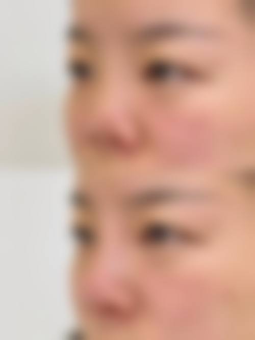 海南煌越医疗美容治疗反馈与口碑评价。