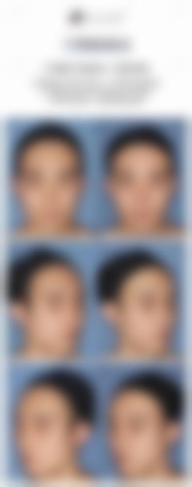哈尔滨医 科 大附属第四 医院整形美容中 心擅长项目