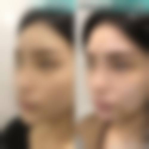 海南煌越医疗美容2026年价格收费表：