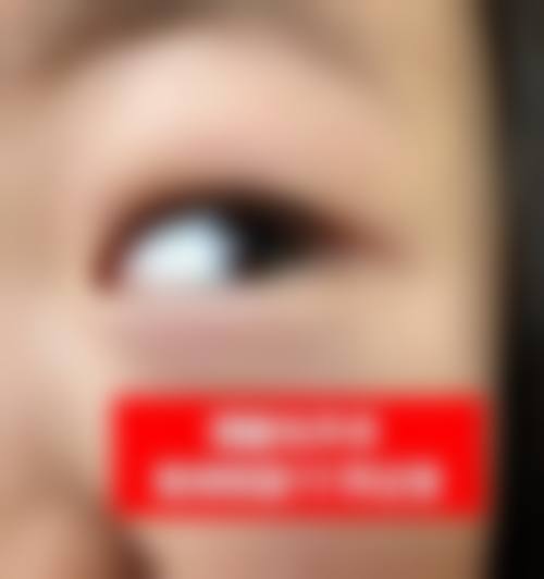 广西医 科 大学附属武鸣医院眼科擅长项目。