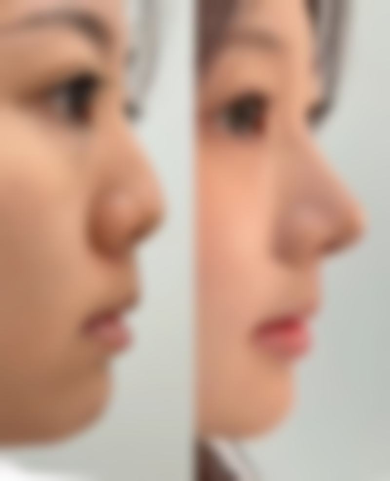 韩国MIND整形外科擅长项目
