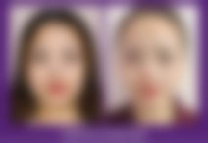 长沙雅美医疗美容医院在轻盈少女脸项目上有怎样的实力?