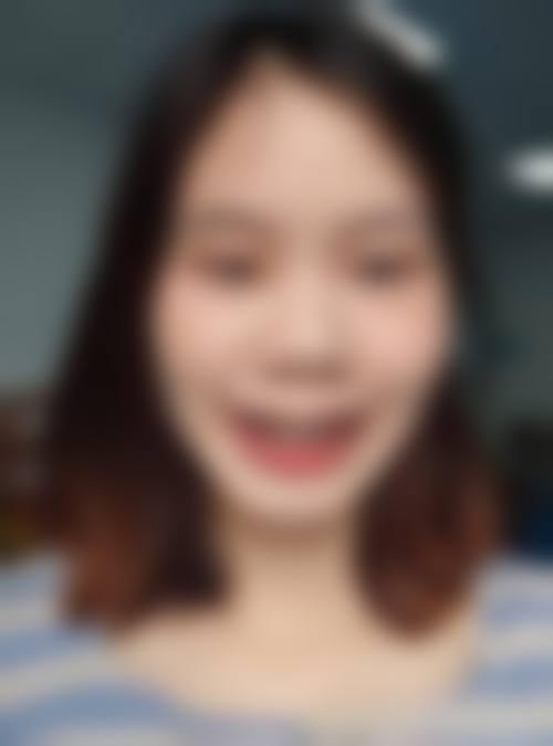 常州洁兰口腔诊所擅长项目。