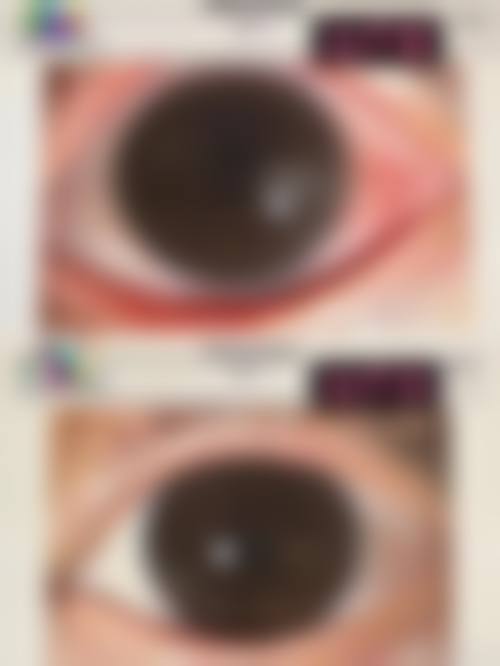 焦作温县仁人和眼科诊所预约挂号方式。