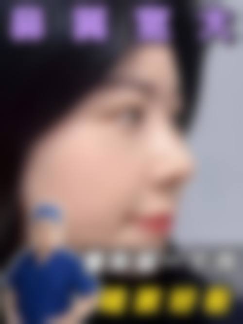 昆明比尔西希医疗美容诊所擅长项目。