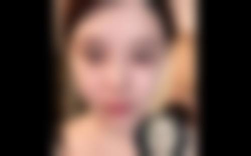 齐齐哈尔市玛丽亚整形医院治疗反馈与口碑评价。