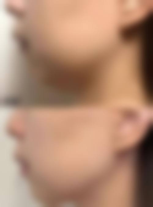 昆明比尔西希医疗美容诊所预约挂号方式。