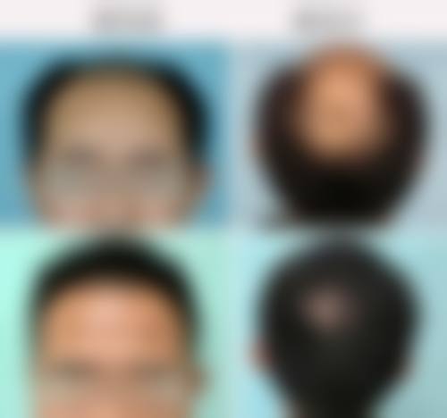 江西赣州俪人医疗美容预约挂号方式。