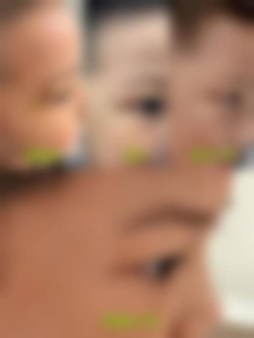 南昌玛恩医疗美容诊所擅长项目。