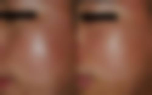 西安慕尚星医疗美容诊所擅长项目。