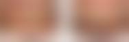 东莞伶俐口腔诊所治疗反馈与口碑评价。