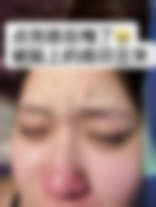 杭州博雅整形医院治疗反馈与口碑评价。
