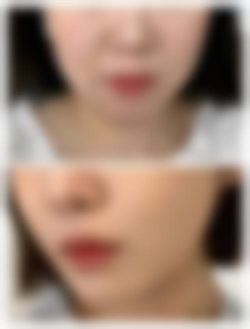 重庆郑荃丽格芭纹医疗美容医生团队经验稳定。