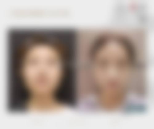 重庆郑荃丽格芭纹医疗美容擅长项目。