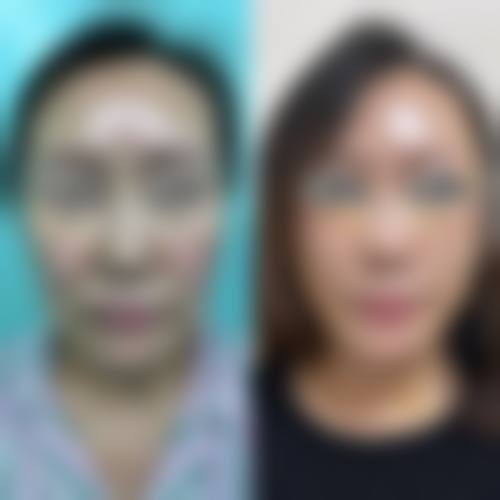 重庆郑荃丽格芭纹医疗美容2026年价格收费表: